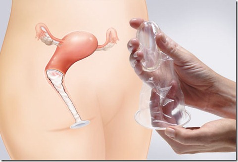 Contraccezione: cos’è il preservativo femminile e come si usa