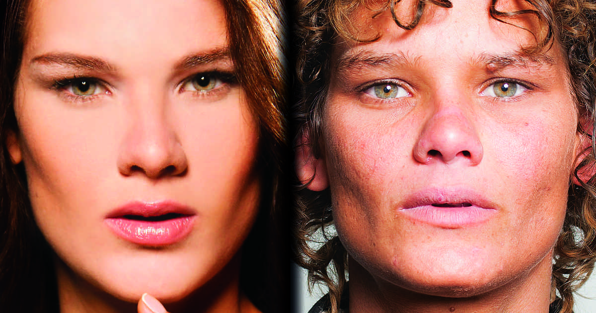Loemy, la modella che voleva essere come Gisele Bundchen distrutta dal crack