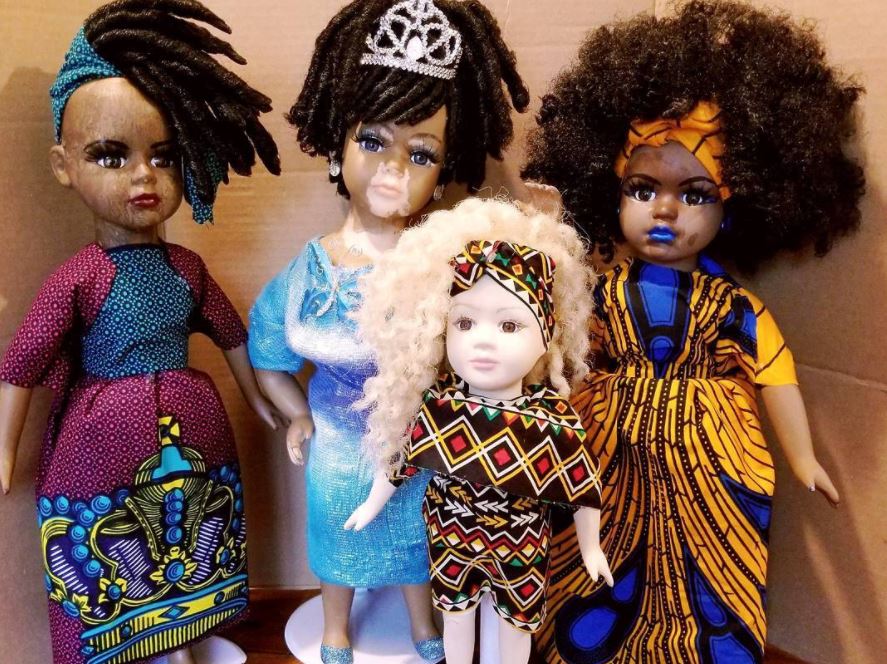 Bambole con la vitiligine: il simbolo di una bellezza diversa