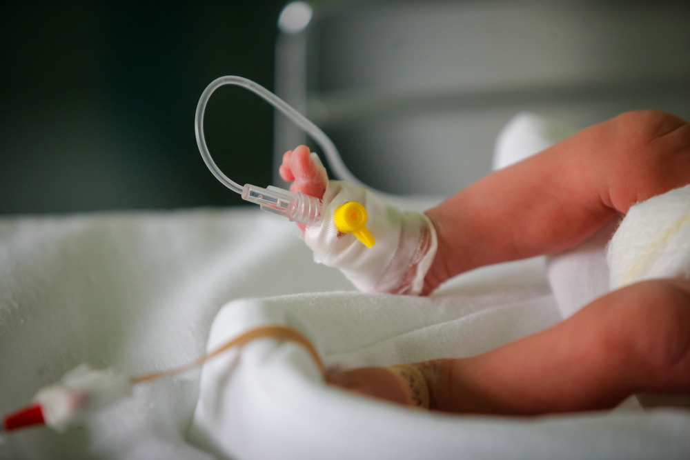 Bambina Down sconfigge il cancro due volte prima di compiere 2 anni
