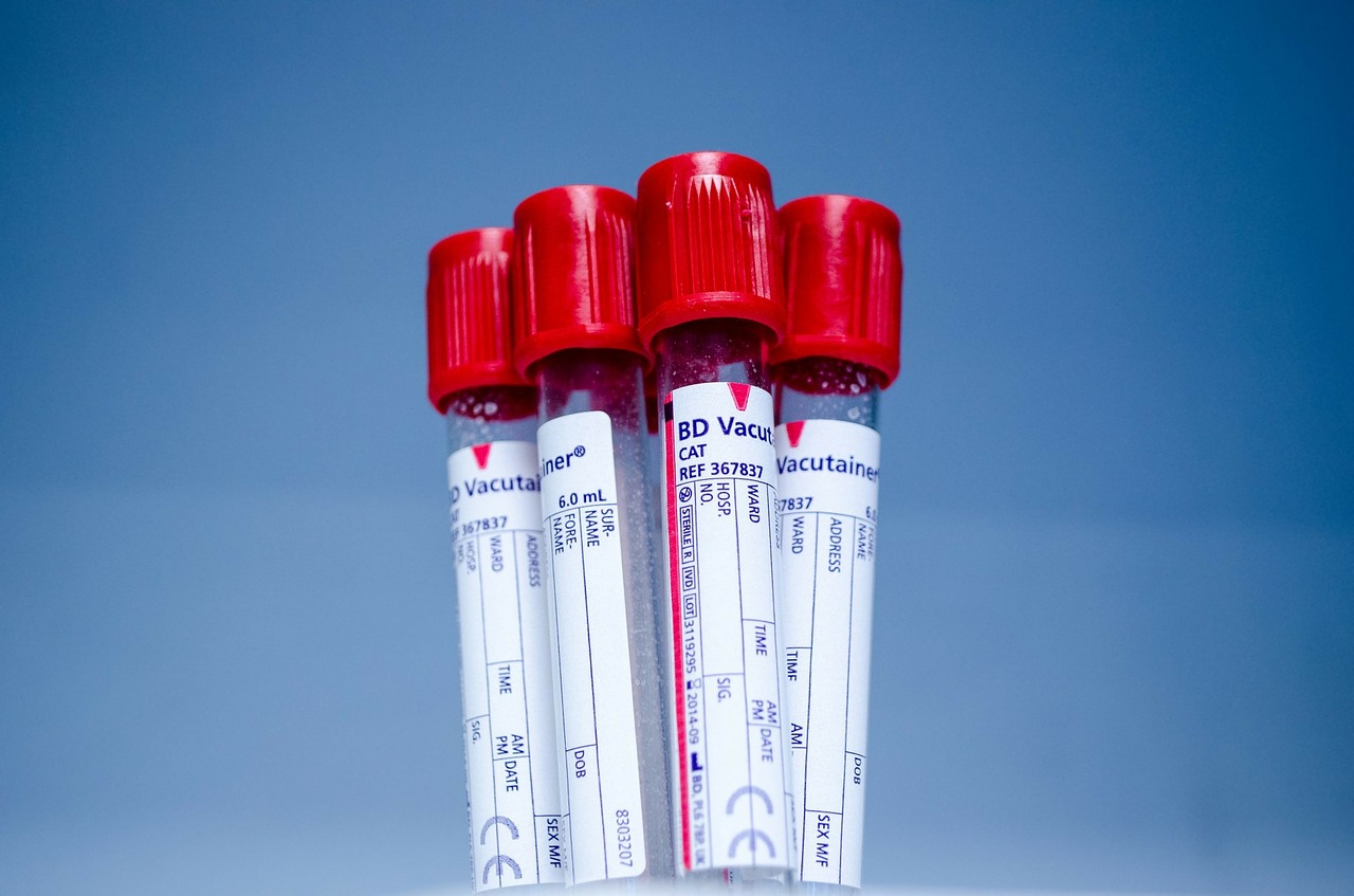 Australia: in pensione uno speciale donatore di sangue di 81 anni che ha salvato 2,4 milioni di bambini