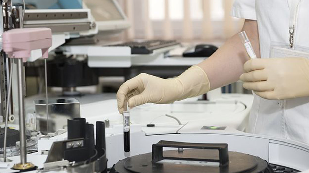 Torino, allarme legionella: morta una 61enne