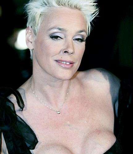 Brigitte Nielson: chirurgia plastica totale