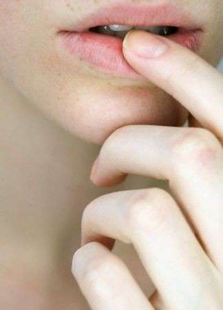 Herpes labiale: come prevenirlo