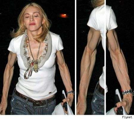 Madonna e le sue braccia orrende!