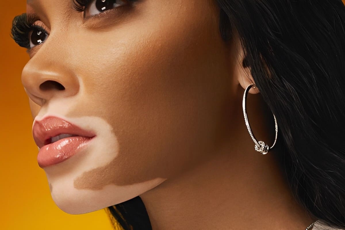 Close-up sul volto di Winnie Harlow focus labbra - come rendere le labbra più carnose con il trucco