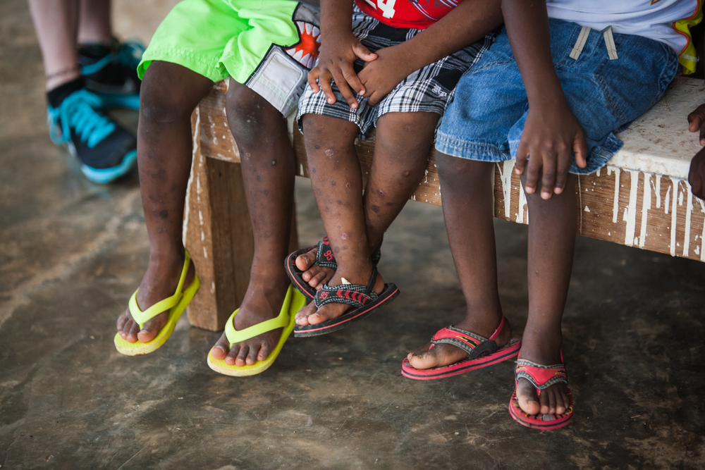 Bambini Haiti