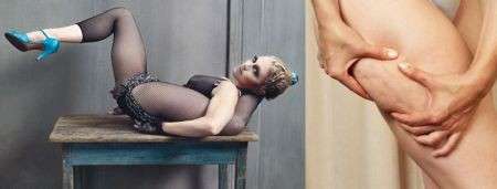 Madonna: 77 mila dollari per liberarsi della cellulite