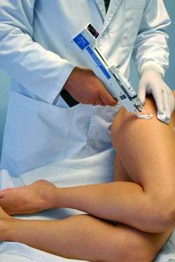 Cellulite, quale trattamento scegliere?