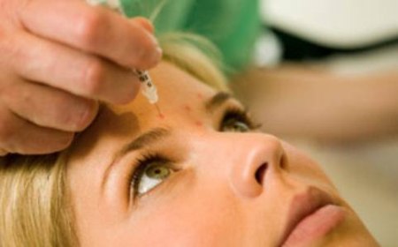 Estetica: filler e botulino per le vacanze