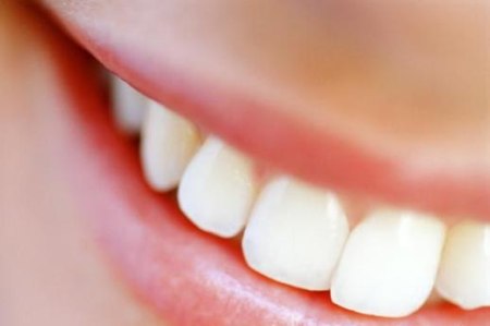 Protesi dentale: al via i controlli gratuiti per un bel sorriso