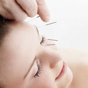 Botox: l’Agopuntura facciale come alternativa