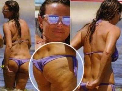 Cellulite: anche le star piangono!