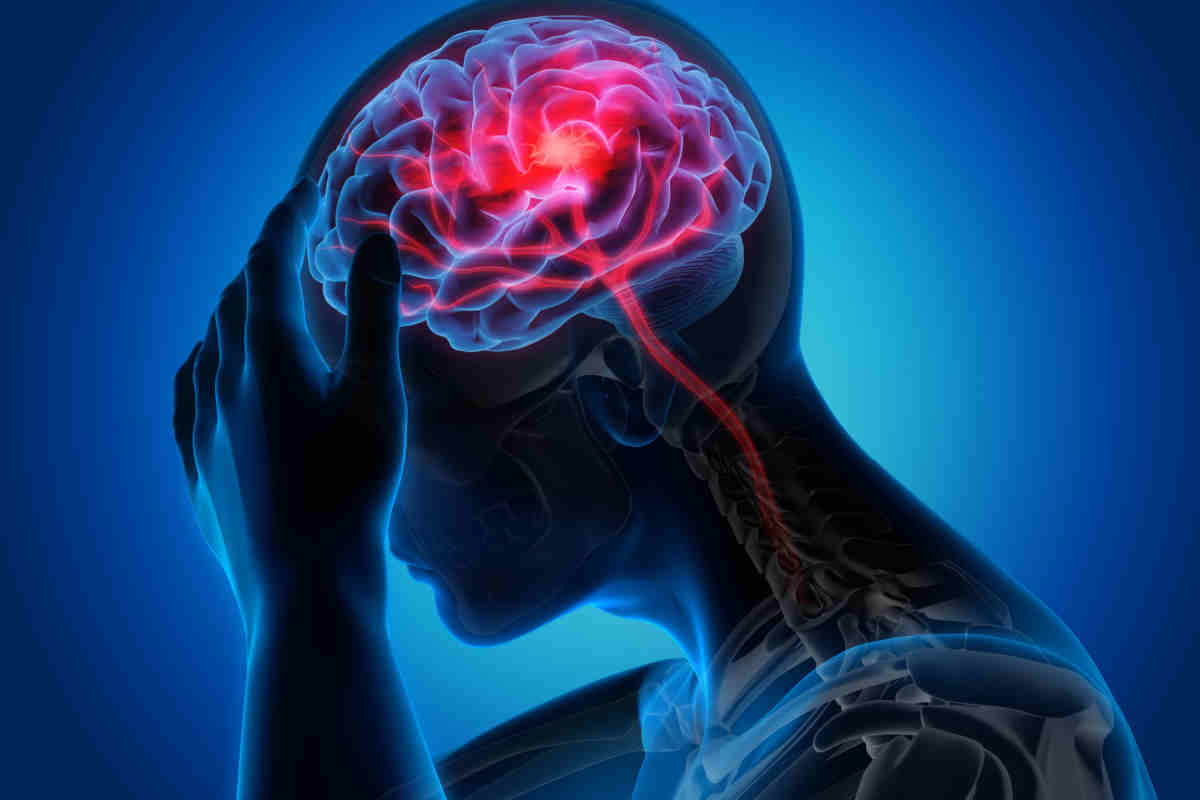 illustrazione 3D di un uomo che si tocca la testa per un dolore forte, con focus sul cervello