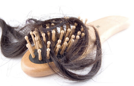 Caduta capelli: rimedi per prevenire e risolvere il problema