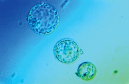 Cellule staminali: scoperto come fanno crescere i tumori