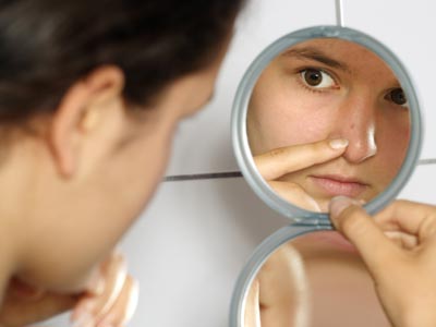 Acne post-adolescenza: dipende dal fumo di sigaretta