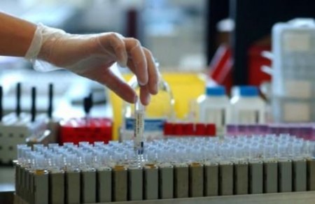 Malattie rare: arriva un semplice test genetico per diagnosticare la trombocitopenia