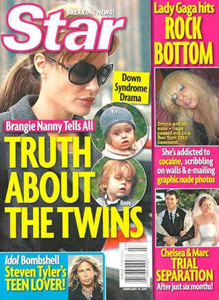 Angelina Jolie e Brad Pitt: i figli hanno la sindrome di Down?