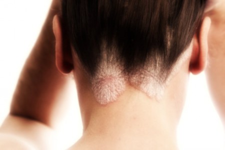 Malattie della pelle, il punto su cure e tecnologie