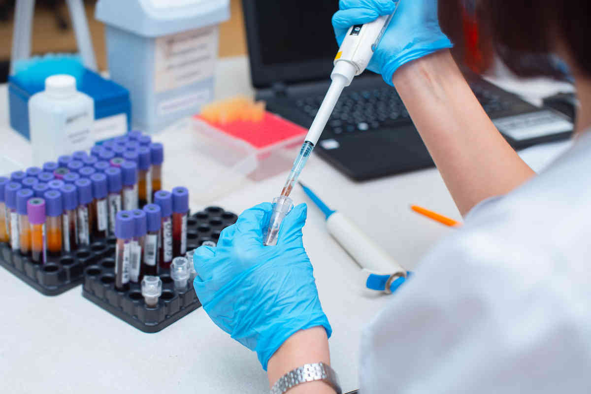 analisi del sangue proteine totali