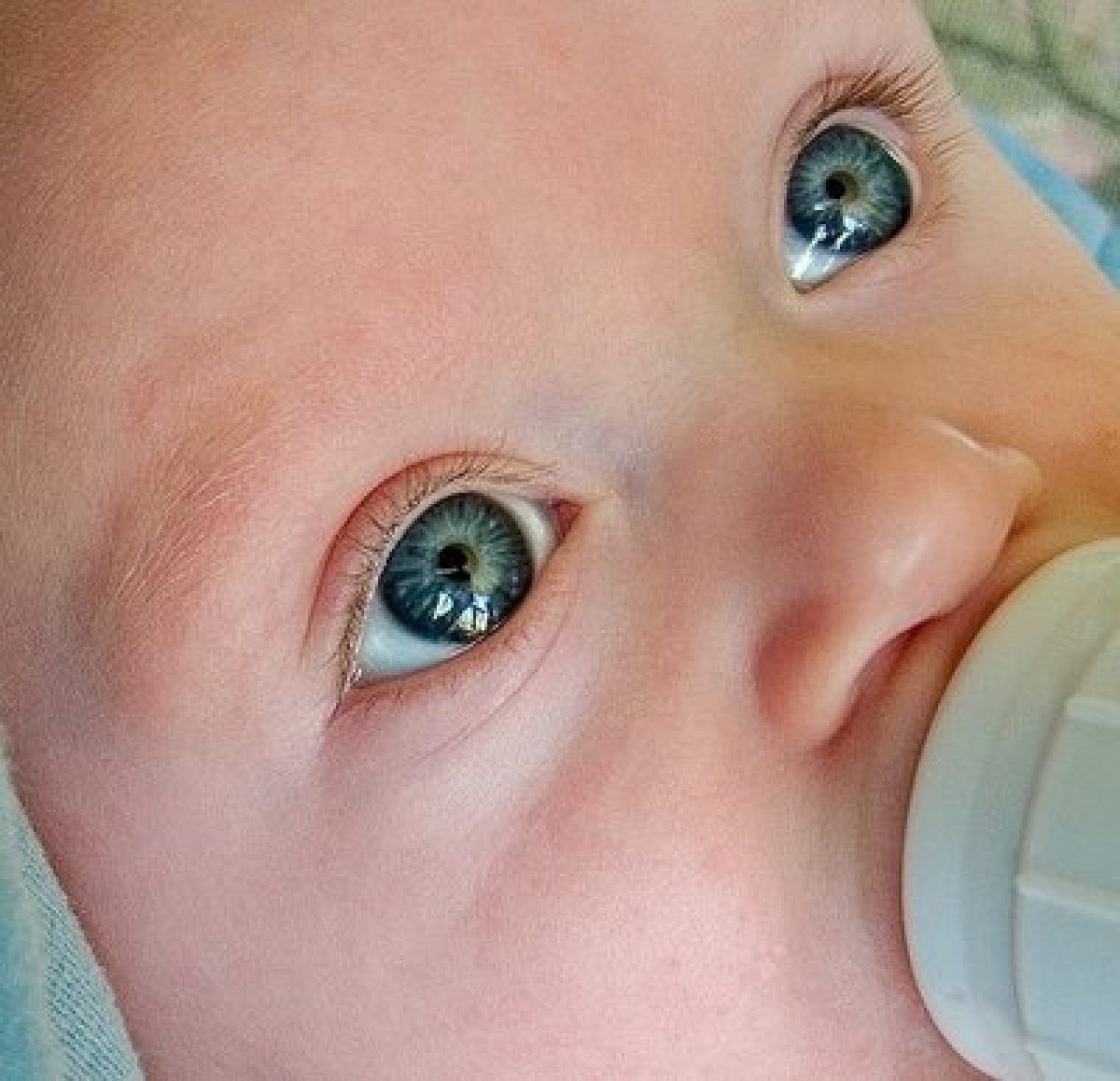 Белки глаз новорожденного. Глаза у новорожденных. Глаза новорожденного ребенка. Конъюнктивит у новорожденных. Ретинопатия новорожденных.