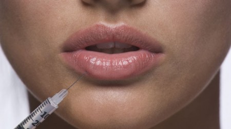 Stop Botox su labbra e occhi, lo impone l’AIFA ma i chirurghi non ci stanno