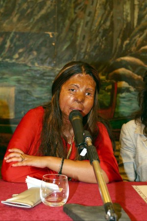 Fakhra Younas si suicida dopo essere stata sfregiata con l’acido