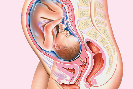Il cerchiaggio in gravidanza possibile soluzione per evitare un parto prematuro