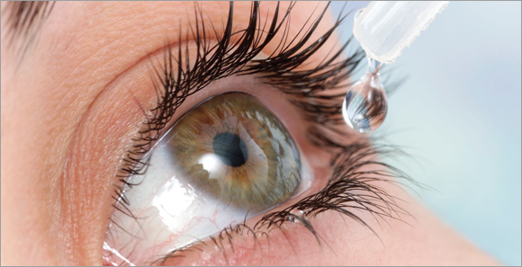 Sindrome dell’occhio secco da lenti a contatto, benefici dai colliri