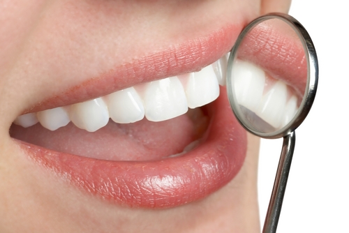 Igiene dentale prevenire cancro