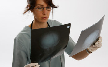 Sconfigge tumore al colon con dieta fai-da-te: è possibile?
