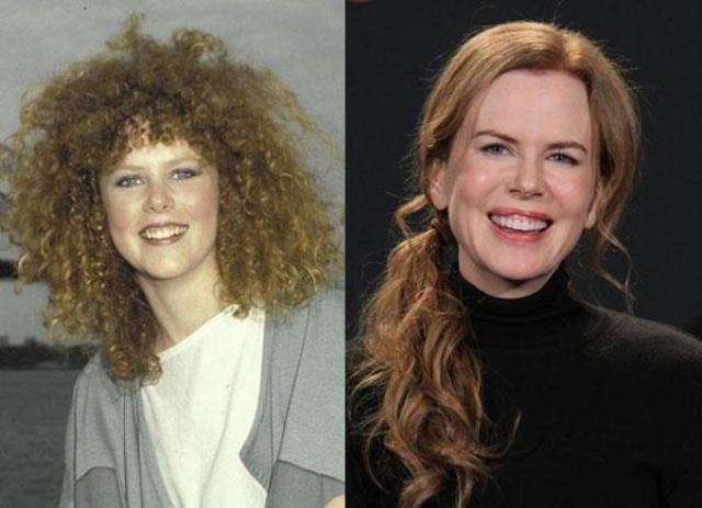 Nicole Kidman rifatta: le foto del prima e del dopo