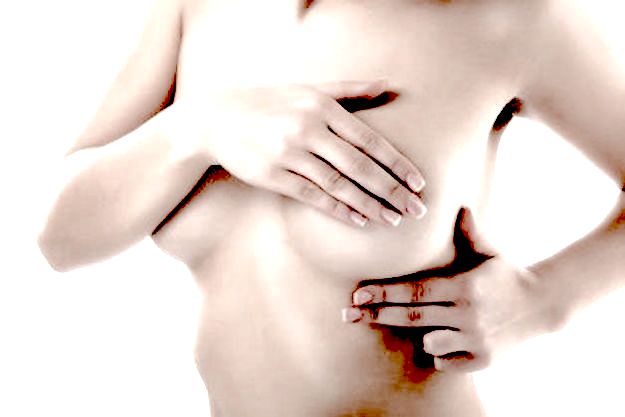 Displasia mammaria: i sintomi e le cure