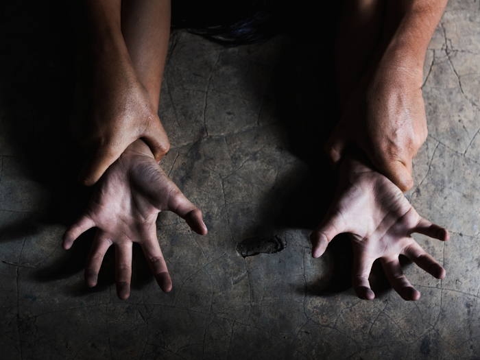 Mutilazioni genitali femmili