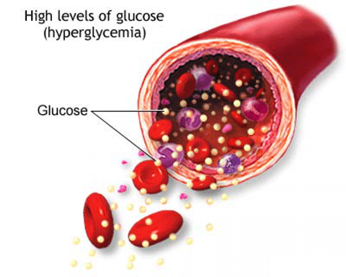 Glucosio alto o basso: i valori e i rimedi