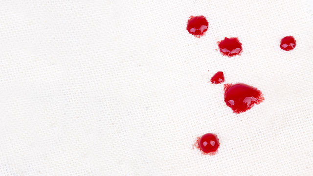 Come eliminare le macchie di sangue: una guida utile