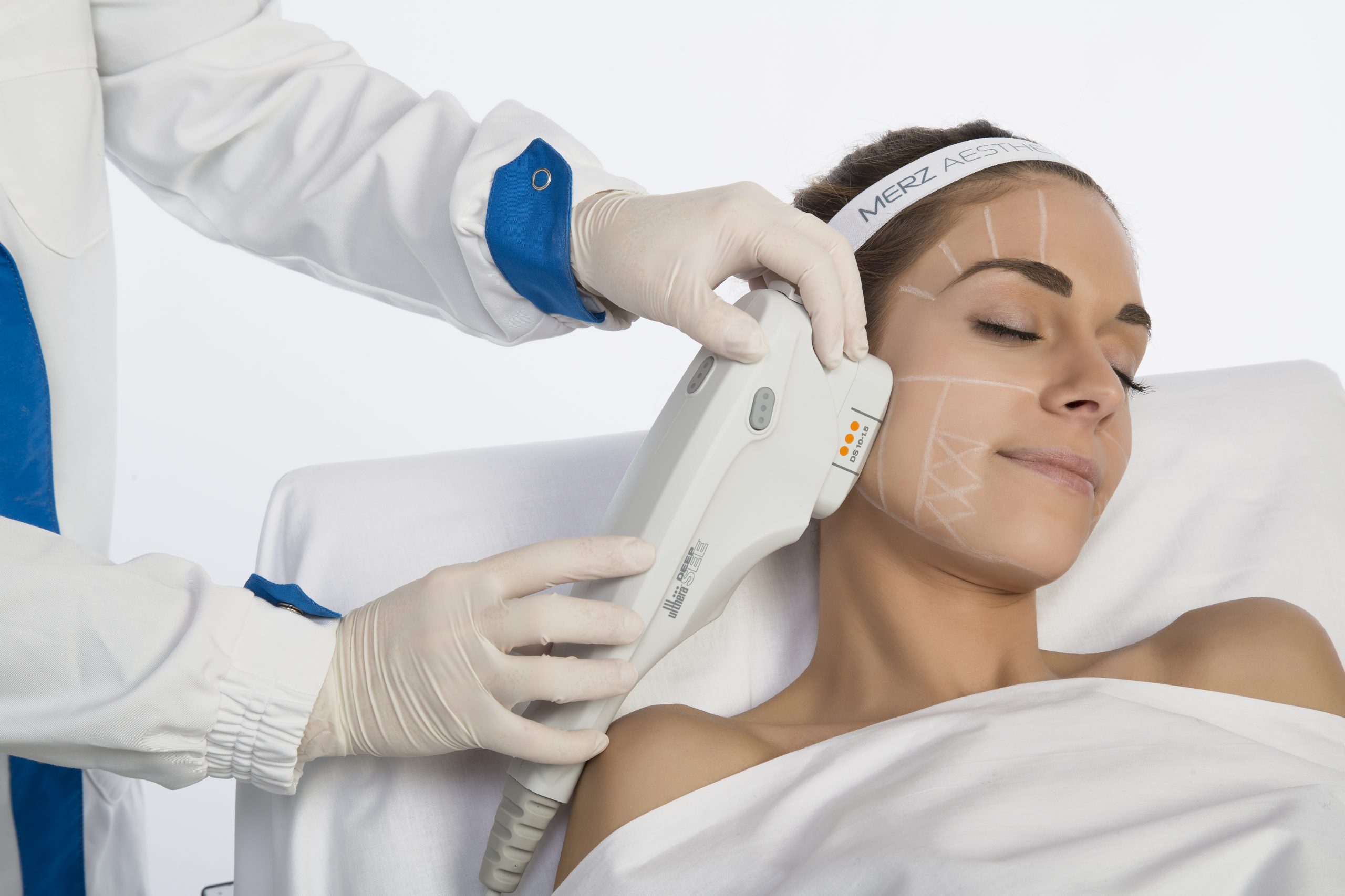 Ultherapy: pelle compatta e liftata in 60 minuti