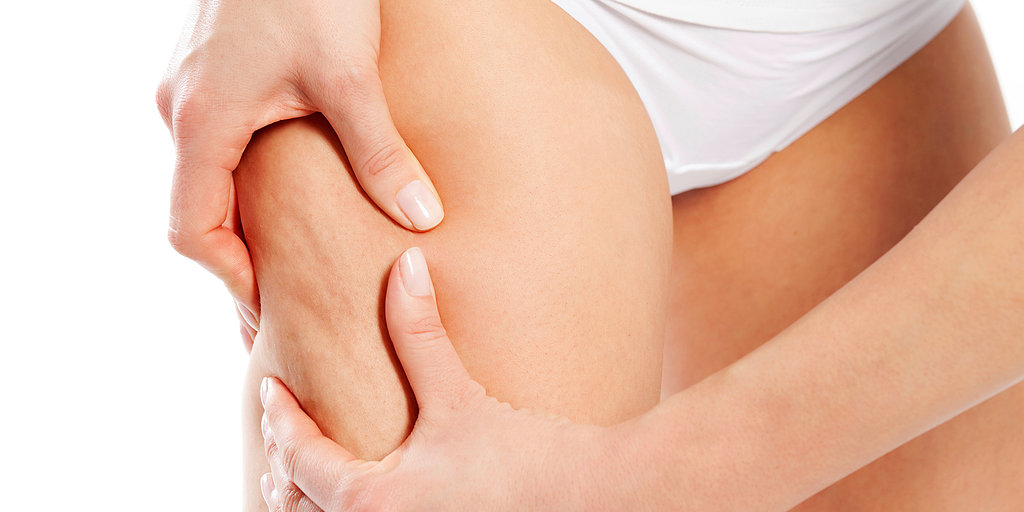 cellulite laser