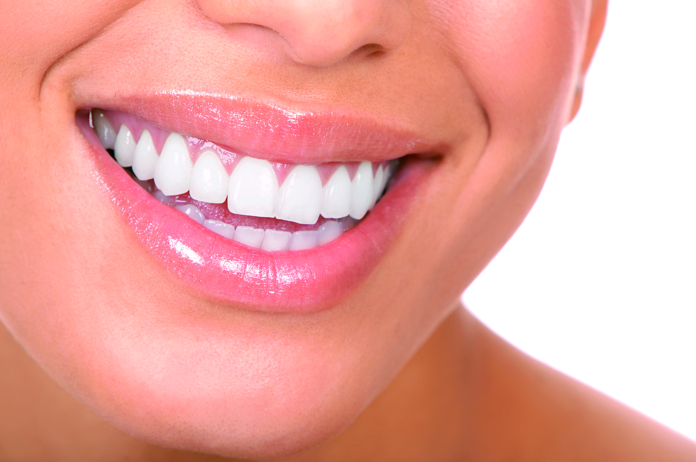 Sbiancamento denti: come funziona?