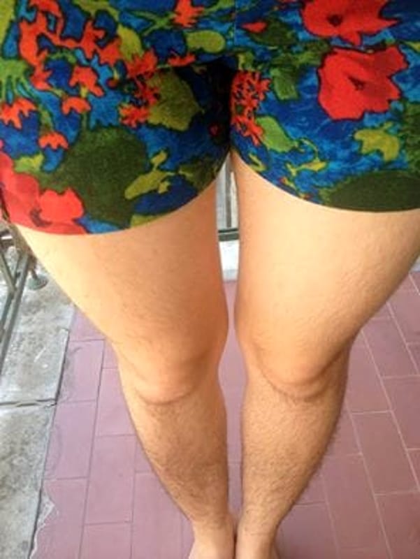 Ragazza si mostra con le gambe pelose su Facebook: il web si divide