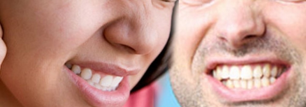 Bruxismo: cause, rimedi e quando serve il bite