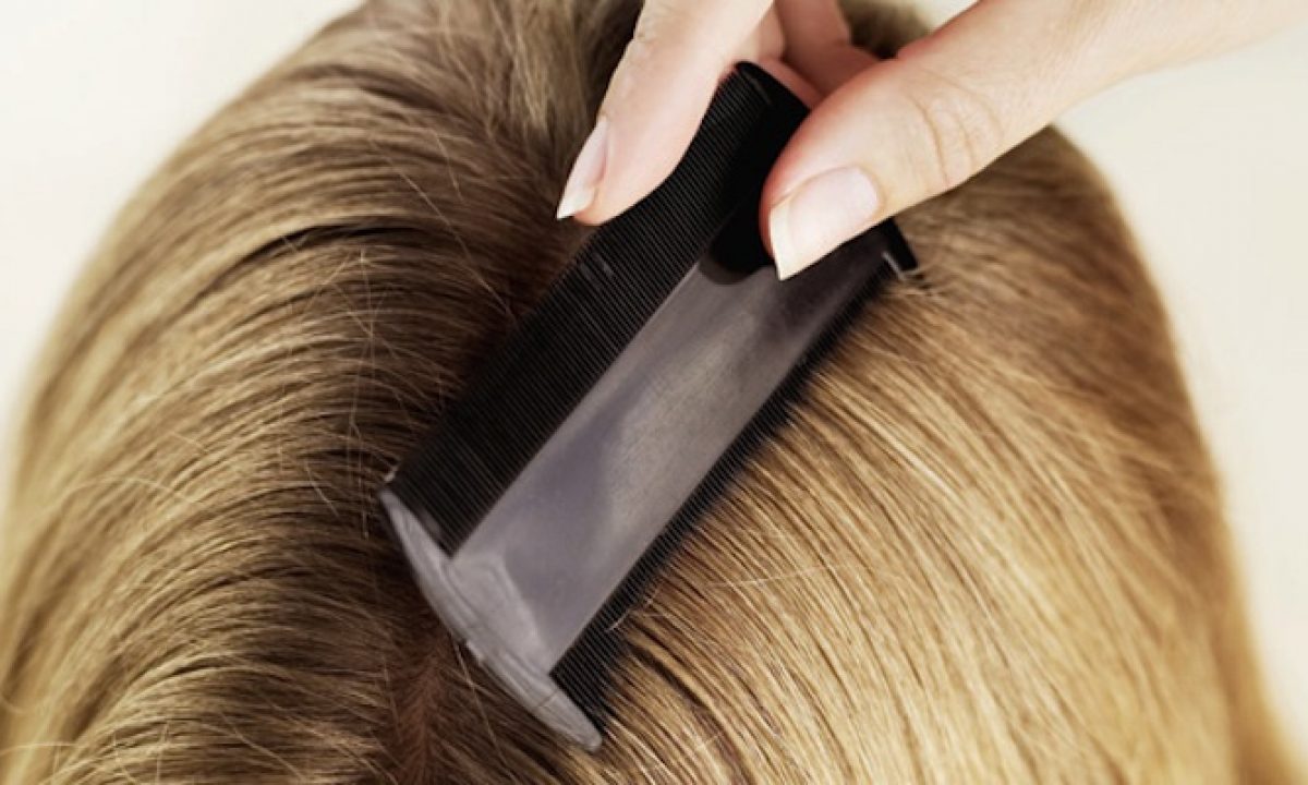 I Modi Per Nascondere La Ricrescita Dei Capelli Pourfemme