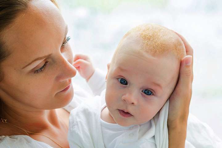 Crosta lattea nel neonato e nel bambino: rimedi naturali e prodotti per curarla