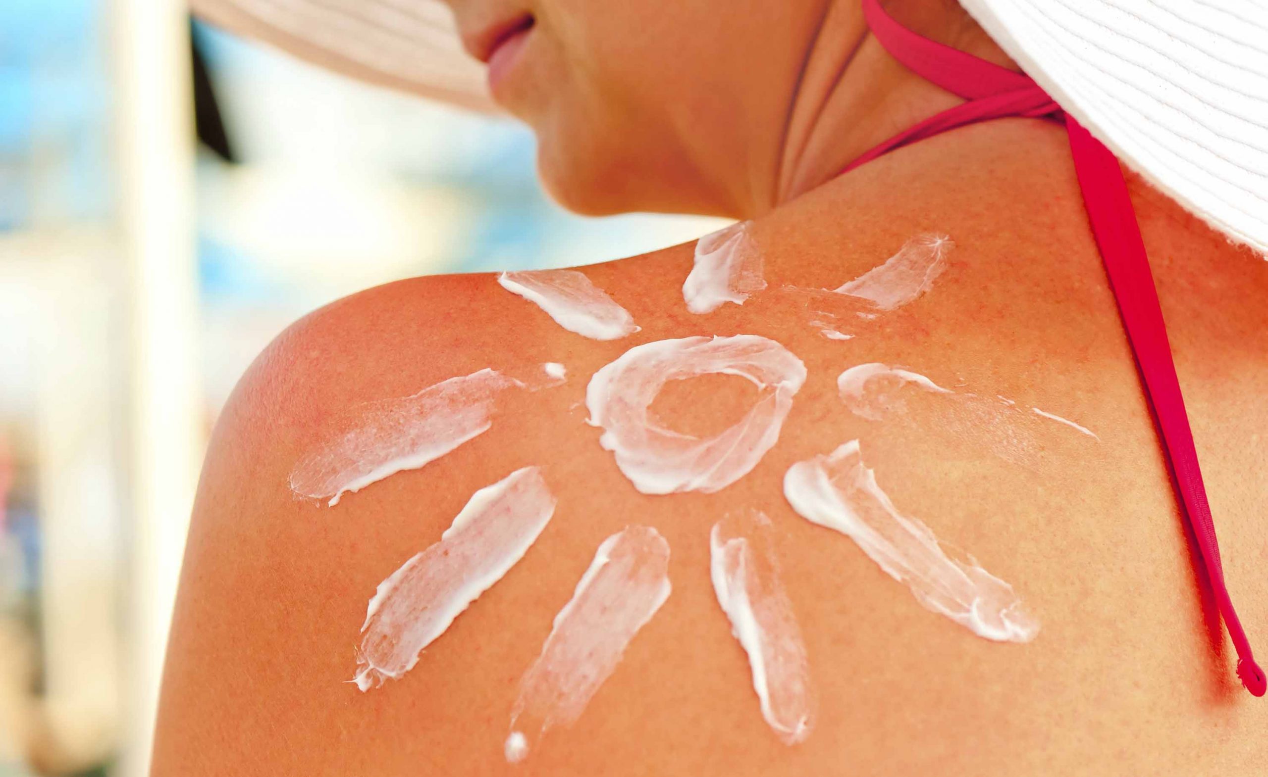 Le Lievi Scottature Le Provocano Sulla Pelle Scottature da sole: rimedi naturali e da farmacia | Pourfemme
