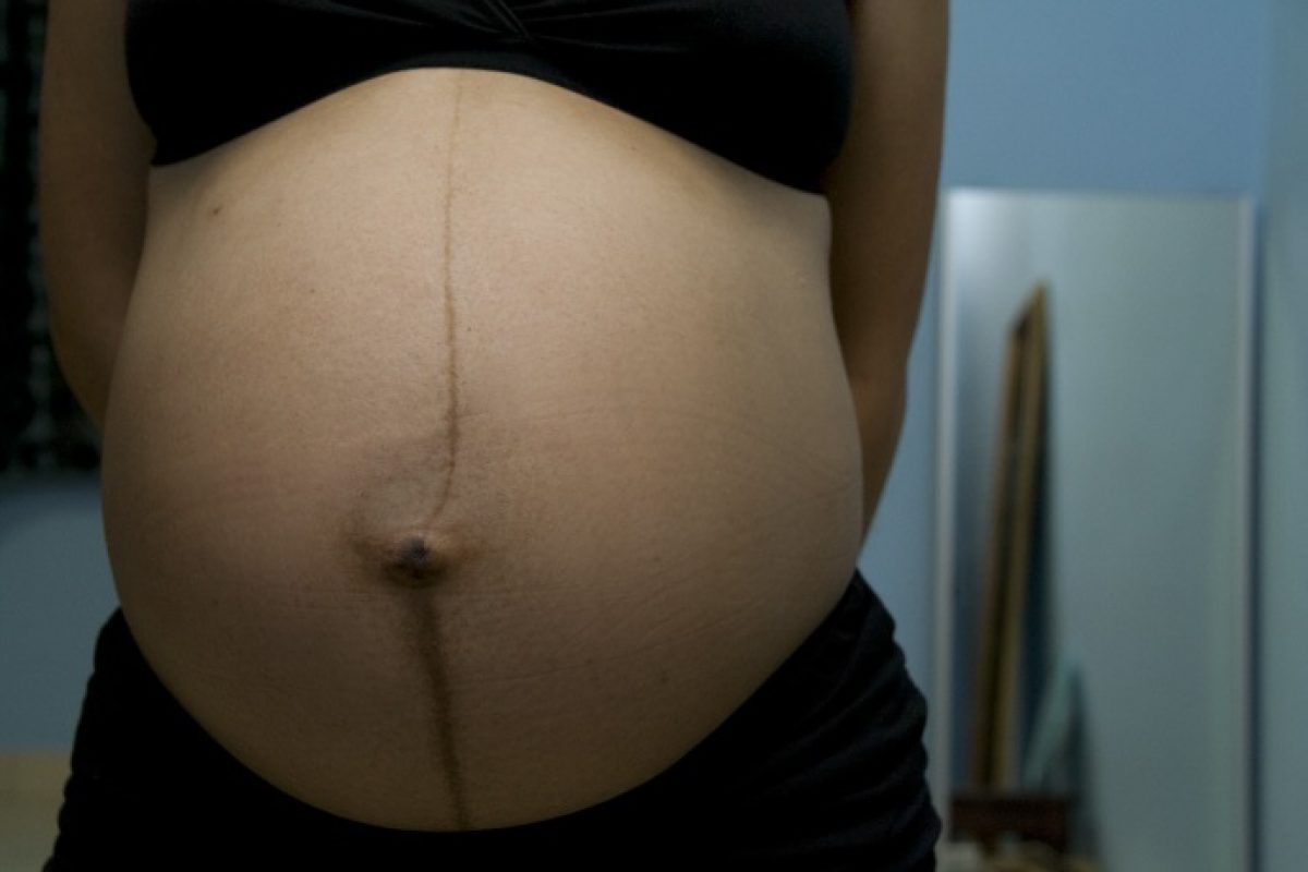 Linea Alba O Linea Nigra In Gravidanza Quando Compare E Cosa Fare Pourfemme