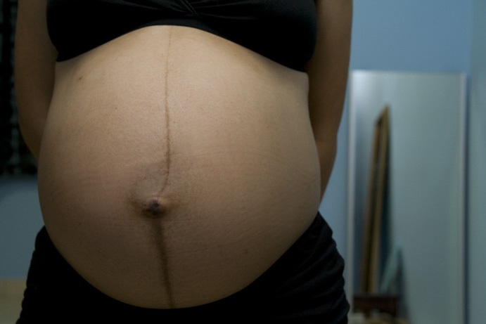 Linea alba o linea nigra in gravidanza: quando compare e cosa fare