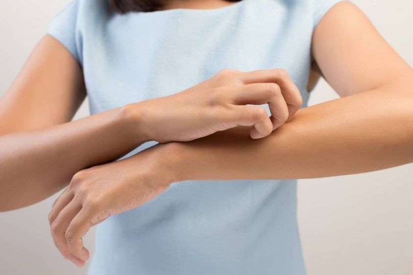 Punture di insetti: sintomi, immagini per riconoscerle e rimedi