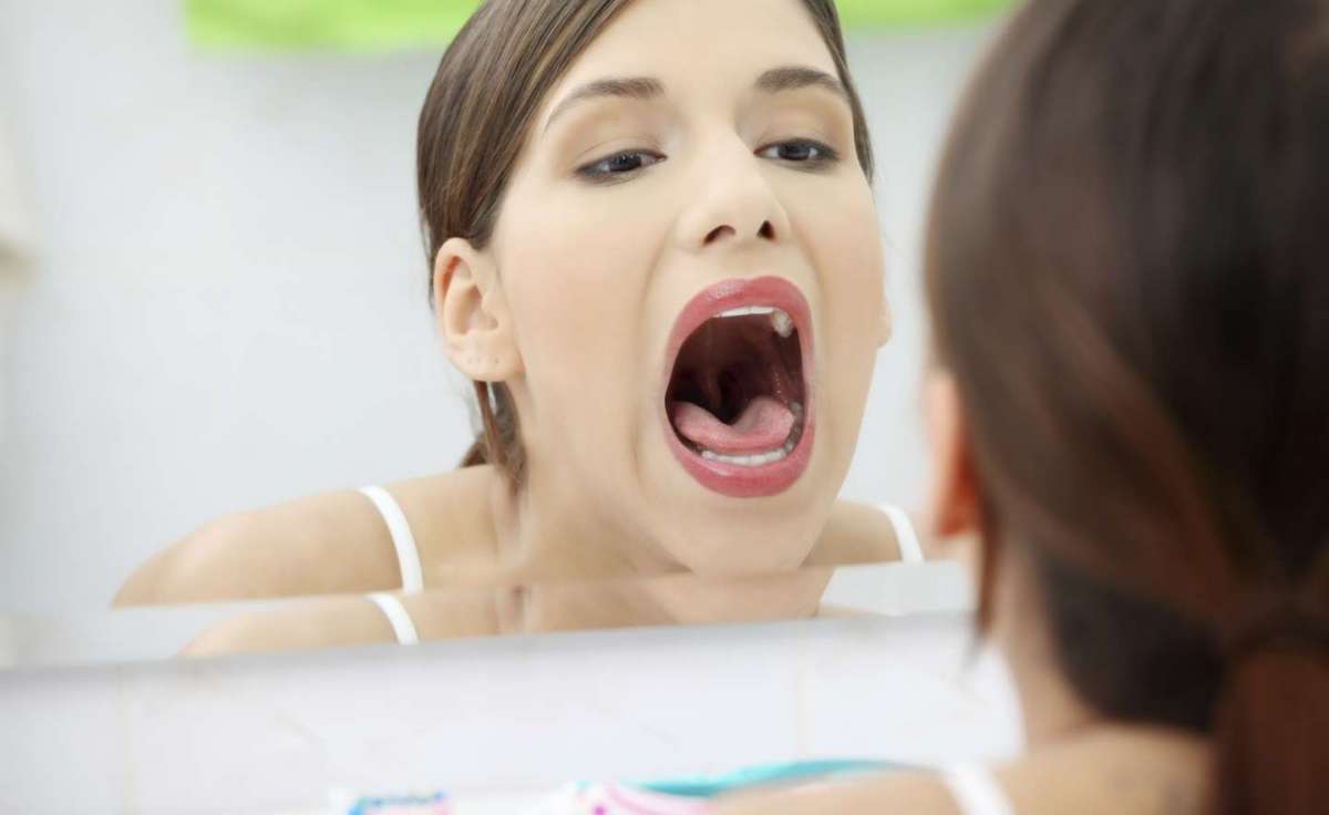 Mughetto o candidosi orale: sintomi, cure e rimedi naturali