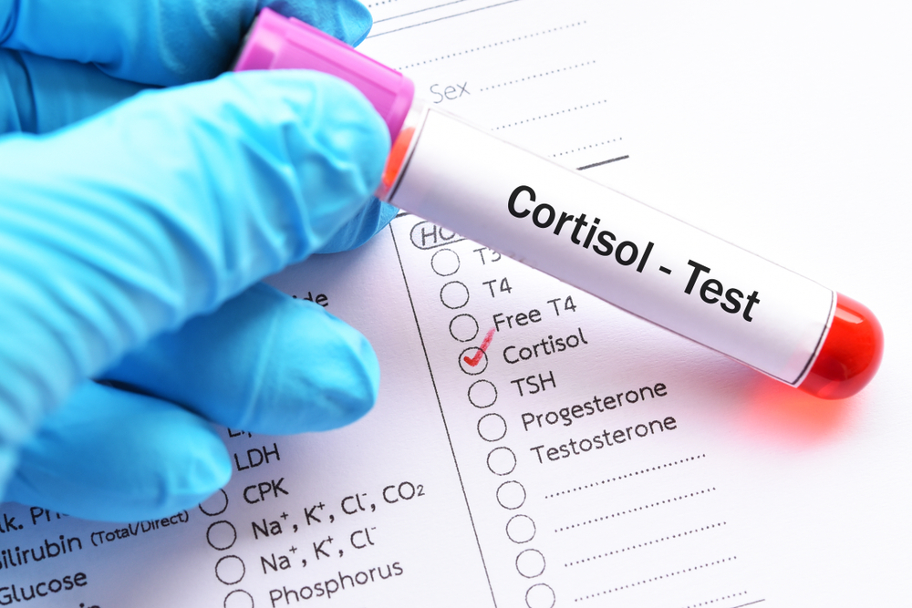 Cortisolo alto o basso, i sintomi e come abbassare il livello dell’ormone dello stress